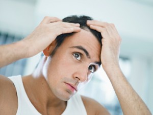 Treatment of Hair Loss Problem 