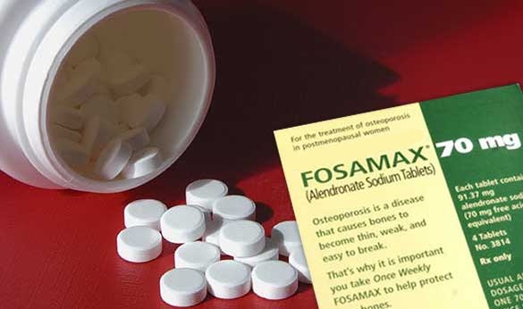 fosamax